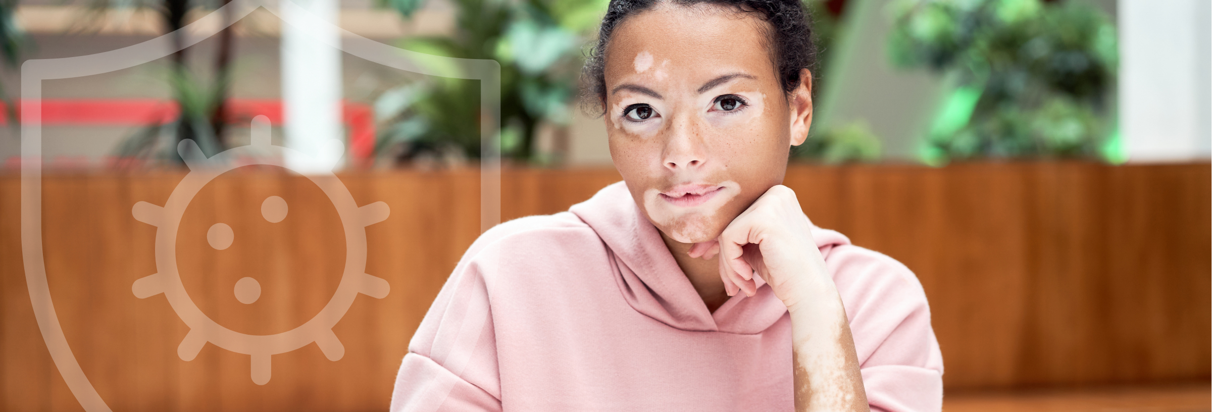 vitligo vitiligo autoimmune disease