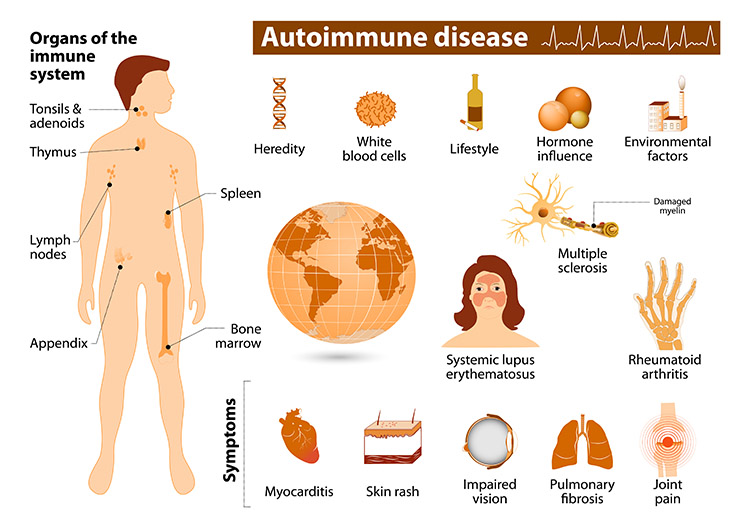autoimmune_disease